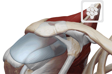 AC Joint Osteolysis | ShoulderDoc by Prof. Lennard Funk