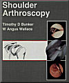 Bunker & Wallace - Shoulder Arthroscopy