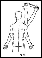 Injecting steroids in shoulder pain