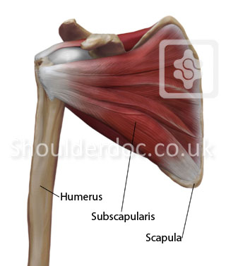 Subscapularis Tear In Muscle 114