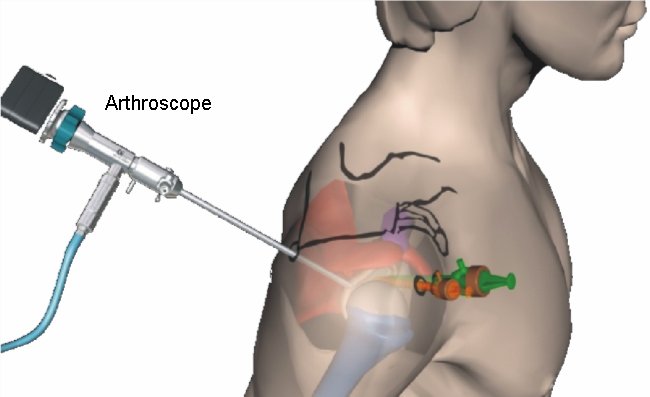 Shoulder Arthroscopy Series: A compilation of lecture notes